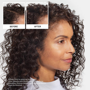 Nioxin Pro Clinical Shampoo Antichute 98520 98520