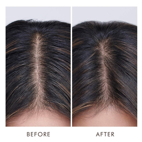 Moroccanoil Traitement Cuir Chevelu Gras 1.5oz RMO-MOR-SONM01