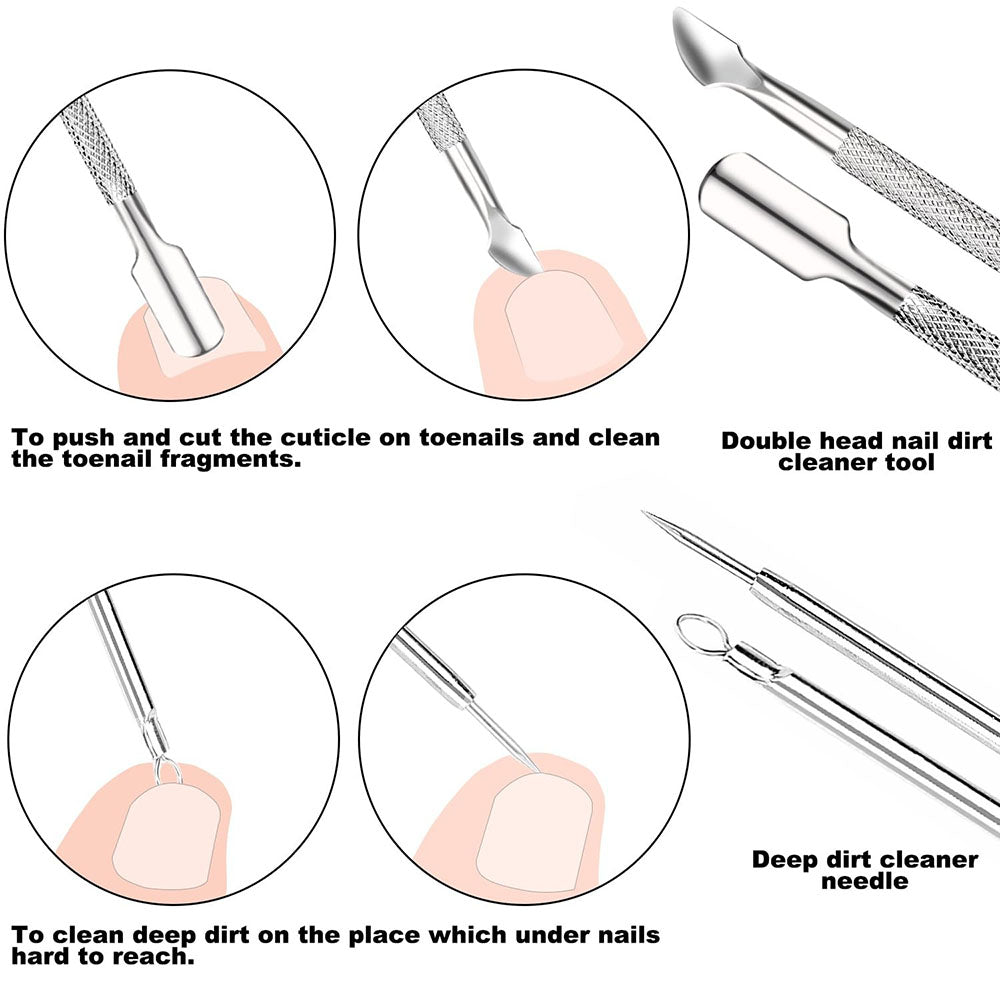 Ensemble de 7 limes et élévateurs pour ongles incarnés 37820