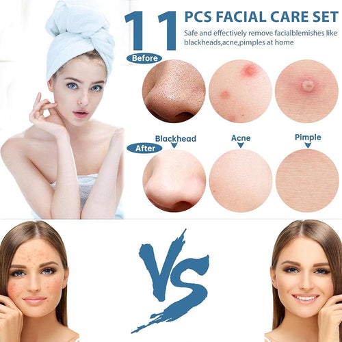 11Pcs Acne Pimples Blackhead Remover Set 45950