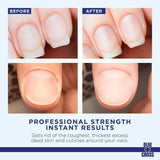 Blue+Cross Cuticle Remover 6 fl oz / 177 ml #106  45914