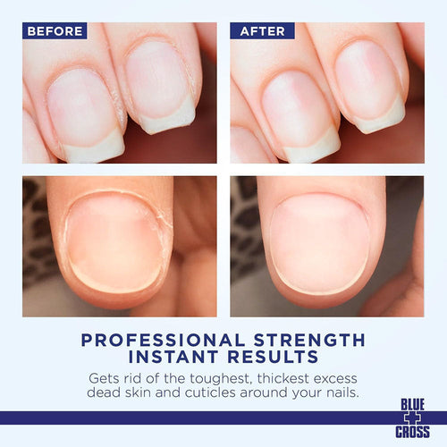 Blue+Cross Cuticle Remover 6 fl oz / 177 ml #106  45914