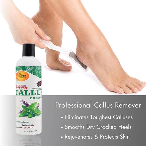 Chemco Spa Redi Dissolvant de Callosités 12 oz Menthe & Eucalyptus 08555