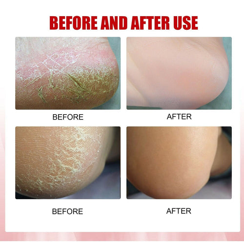 Gehwol Soft Feet Beurre Grenade & Moringa 100ml 1112906