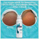 Footlogix #1 Mousse DD Crème 4.23 oz./119.9 g 06131