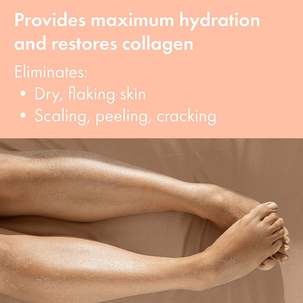 Vite20 Skin Care Cream Dry Skin & Cracked Heels 8oz 233001