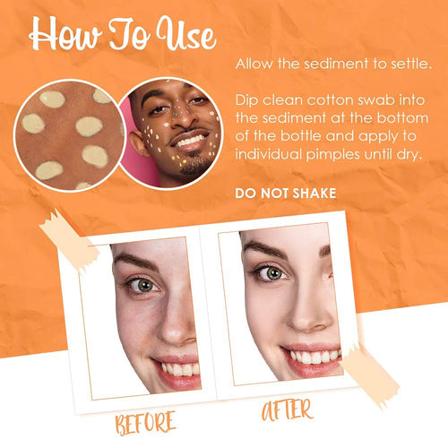 ByeBye Blemish Vitamin C DarkSpot Lotion 1 fl oz 30 ml 16403